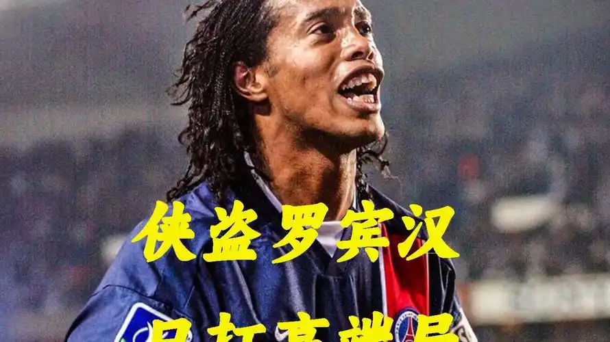 球业务的